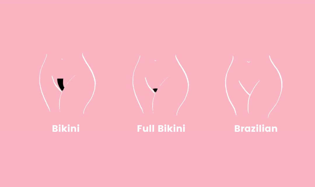 Bikini Sugaring Styles – Which is Right For You?